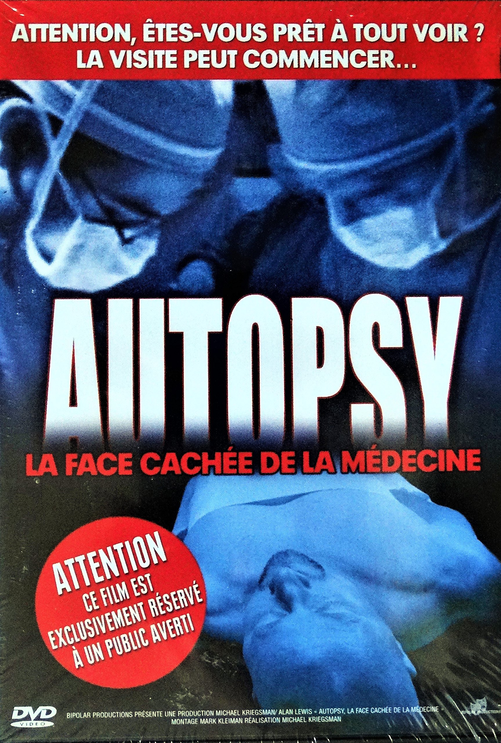 Autopsy - La Face Cachée De La Médecine